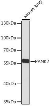 PANK2 Rabbit Polyclonal Antibody (CAB18502)