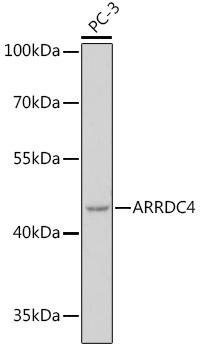 ARRDC4 Rabbit Polyclonal Antibody (CAB18522)