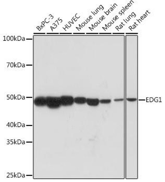 Anti-EDG1 Antibody (CAB3997)