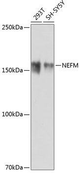 Neurofilament M Rabbit Monoclonal Antibody (CAB19085)