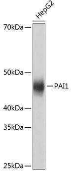 PAI-1/Serpin E1 Rabbit Monoclonal Antibody (CAB19096)