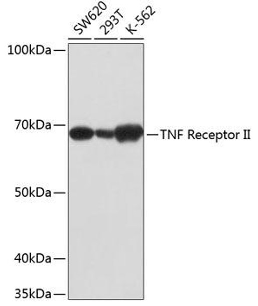 TNFR2/TNFRSF1B Rabbit Monoclonal Antibody (CAB19127)