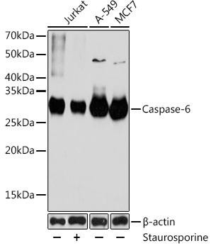 Caspase-6 Rabbit Monoclonal Antibody (CAB19552)