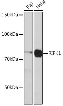RIPK1/RIP Rabbit Monoclonal Antibody (CAB19580)