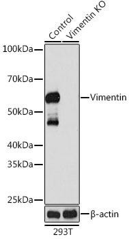 [KO Validated] Vimentin Rabbit Monoclonal Antibody (CAB19607)