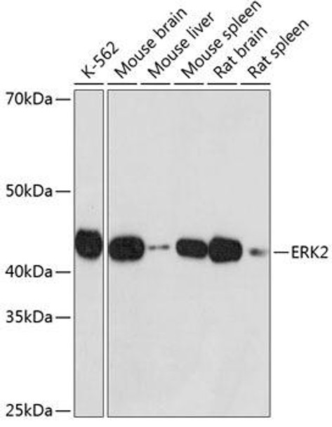 [KO Validated] ERK2 Rabbit Monoclonal Antibody (CAB19630)