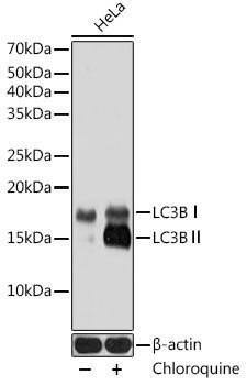 [KO Validated] LC3B Rabbit Monoclonal Antibody (CAB19665)