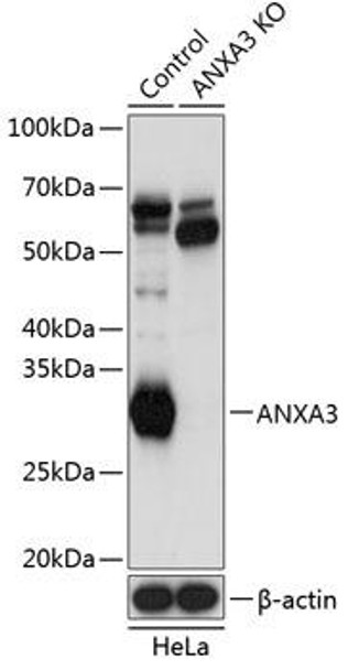 [KO Validated] ANXA3 Rabbit Polyclonal Antibody (CAB19861)