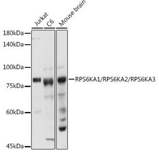 Anti-RPS6KA1/RPS6KA2/RPS6KA3 Antibody (CAB20285)