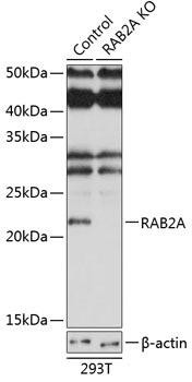 [KO Validated] RAB2A Rabbit Polyclonal Antibody (CAB19982)