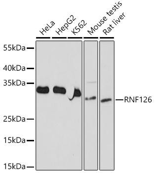 RNF126 Rabbit Polyclonal Antibody (CAB20015)