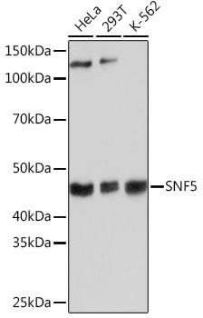 [KO Validated] SMARCB1/SNF5 Rabbit Monoclonal Antibody (CAB3247)