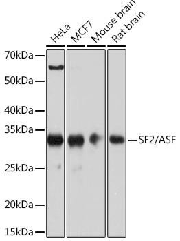 SRSF1/SF2/ASF Rabbit Monoclonal Antibody (CAB4091)