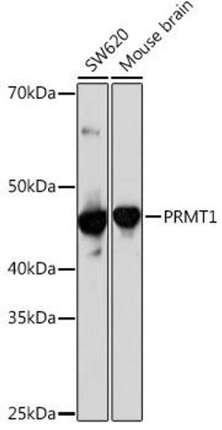 PRMT1 Rabbit Monoclonal Antibody (CAB4502)