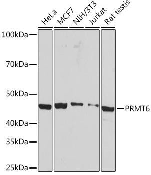 PRMT6 Rabbit Monoclonal Antibody (CAB5085)