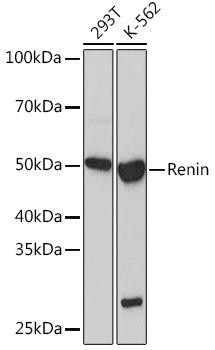Renin Rabbit Monoclonal Antibody (CAB5197)