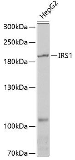 Anti-IRS1 Antibody (CAB0245)