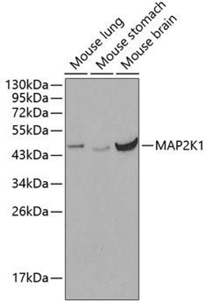 Anti-MAP2K1 Antibody (CAB0252)