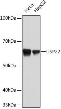 USP22 Rabbit Monoclonal Antibody (CAB9261)