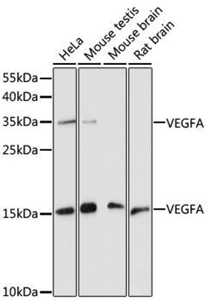 Anti-VEGFA Antibody (CAB0280)