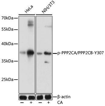 Phospho-PPP2CA/PPP2CB-Y307 Rabbit Polyclonal Antibody (CABP0927)