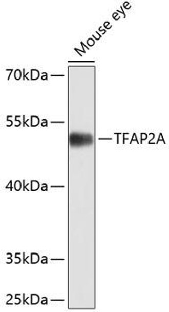 Anti-TFAP2A Antibody (CAB0416)