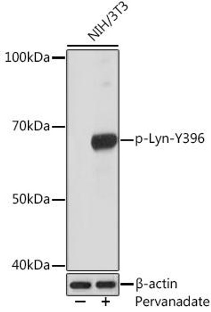 Phospho-Lyn-Y396 Rabbit Monoclonal Antibody (CABP1050)