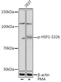 Phospho-HSF1-S326 Rabbit Monoclonal Antibody (CABP1140)