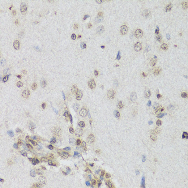 Anti-NRF2 Antibody (CAB0674)