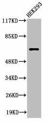 Cleaved-ITIH2 (D702) Antibody (PACO00051)