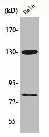 Phospho-ADD1/ADD2 (S726/713) Antibody (PACO00316)