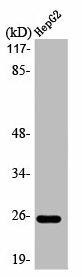 LTB Antibody (PACO01032)