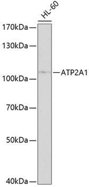 Anti-ATP2A1 Antibody (CAB10104)
