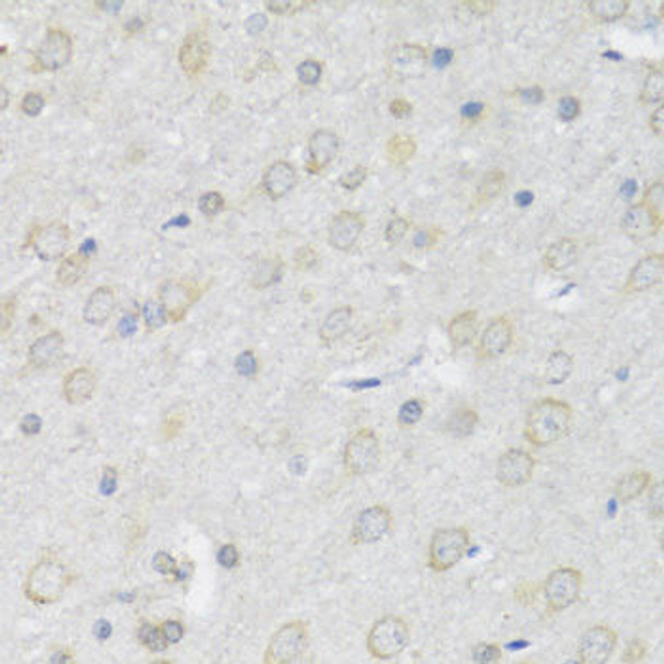 Anti-P2RX7 Antibody (CAB10511)