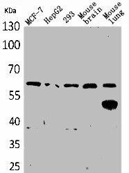 ZKSCAN4 Antibody (PACO02013)