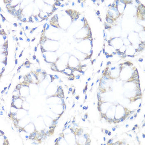 Anti-SDHB Antibody (CAB10821)