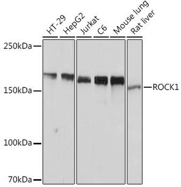 Anti-ROCK1 Antibody (CAB11158)