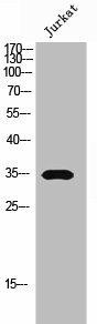 OR5AR1 Antibody (PACO02695)