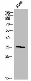 OR5B12 Antibody (PACO02862)