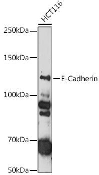 Anti-E-Cadherin Antibody (CAB11453)