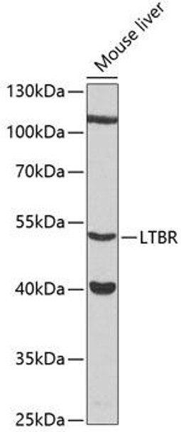 Anti-LTBR Antibody (CAB12006)