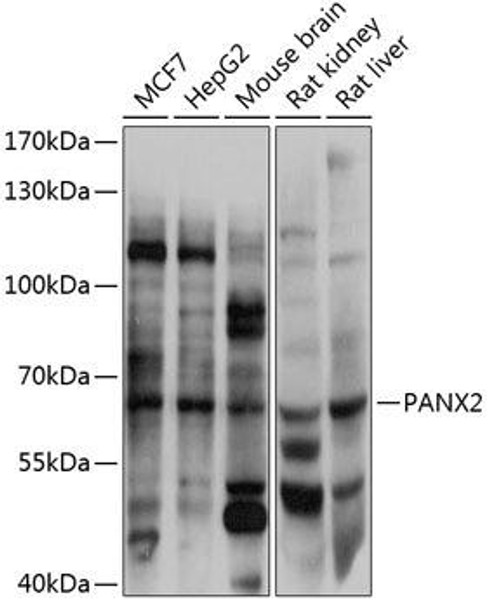 Anti-PANX2 Antibody (CAB12281)