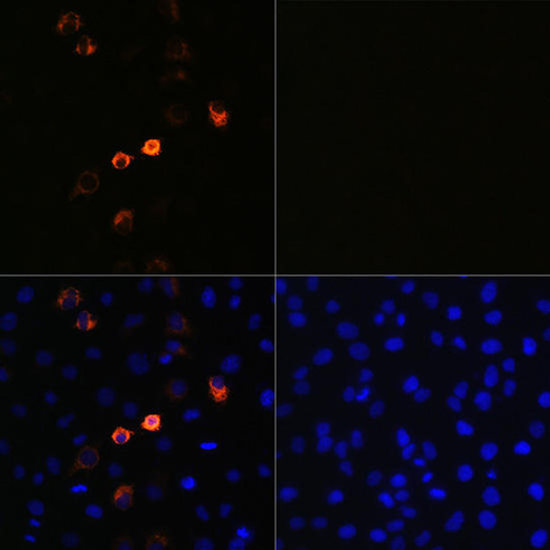 SARS-CoV-2 Spike S1 Monoclonal Antibody (CAB20022)