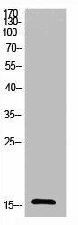 Acetyl-UBA52/RPS27A/UBB/UBC (K27) Antibody (PACO06073)