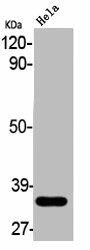 ABCC13 Antibody (PACO06216)
