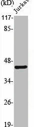 PROKR1 Antibody (PACO06765)