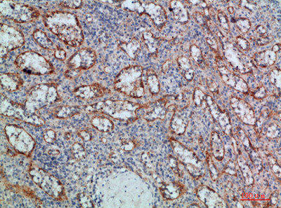 LTB Antibody (PACO07384)