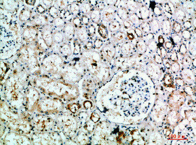 DLEU7 Antibody (PACO07390)