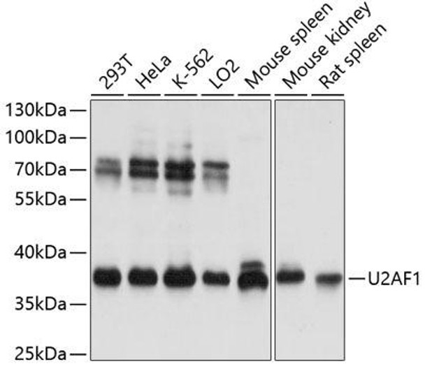 Anti-U2AF1 Antibody (CAB13166)