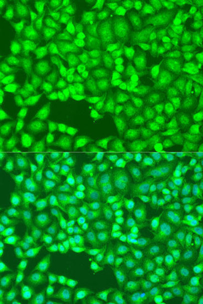 Anti-FLT4 Antibody (CAB13304)